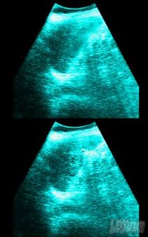 Lifesigns - Hospital Affairs, al descubierto con nuevas imágenes