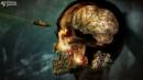 imágenes de Zombie Army 4: Dead War 